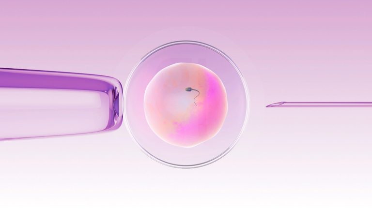 Tandem IVF
